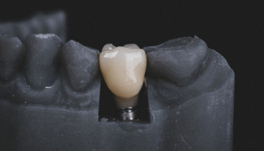 implanty er-dental.pl